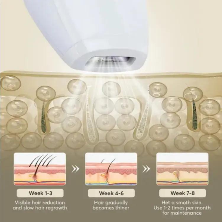 Professional Laser Epilator IPL Hair Removal Body Bikini Leg CJDropshipping