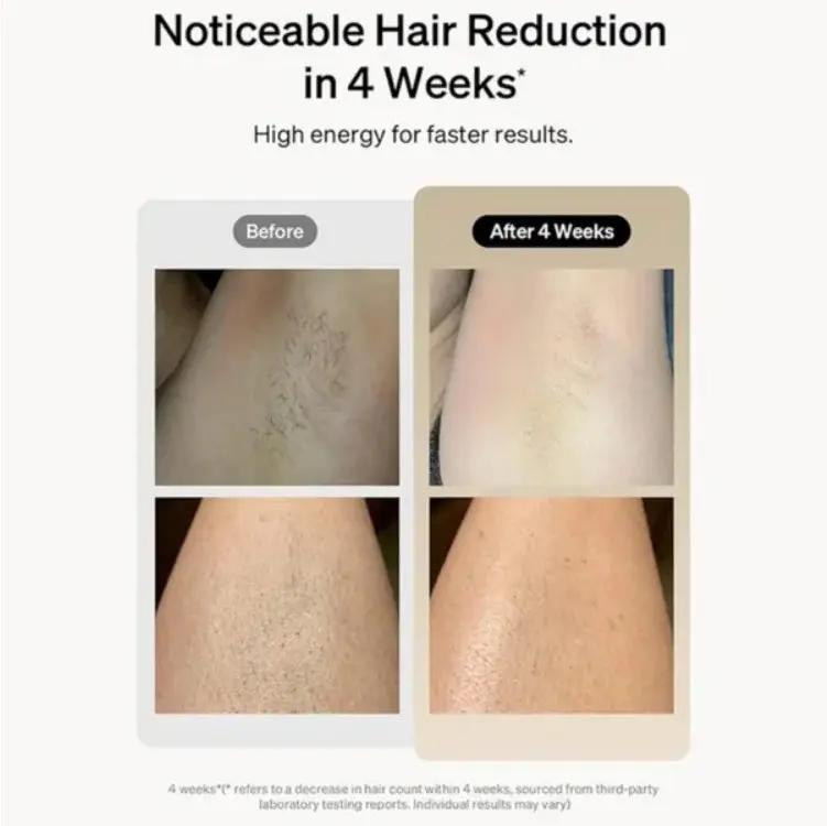 Professional Laser Epilator IPL Hair Removal Body Bikini Leg CJDropshipping