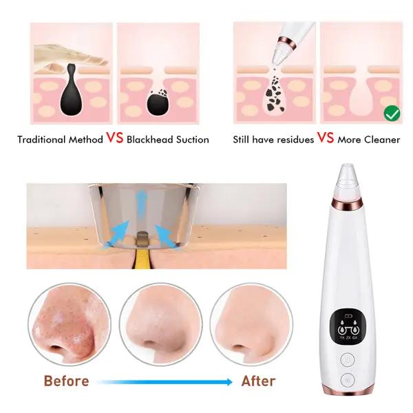 Facial microcry stalline blackhead skin beauty instrument Teal Simba