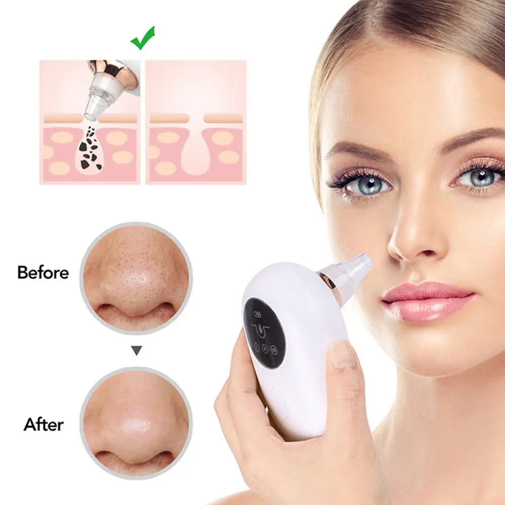 Portable  Face Deep Pore Cleaner Vacuum Blackhead Remover Teal Simba
